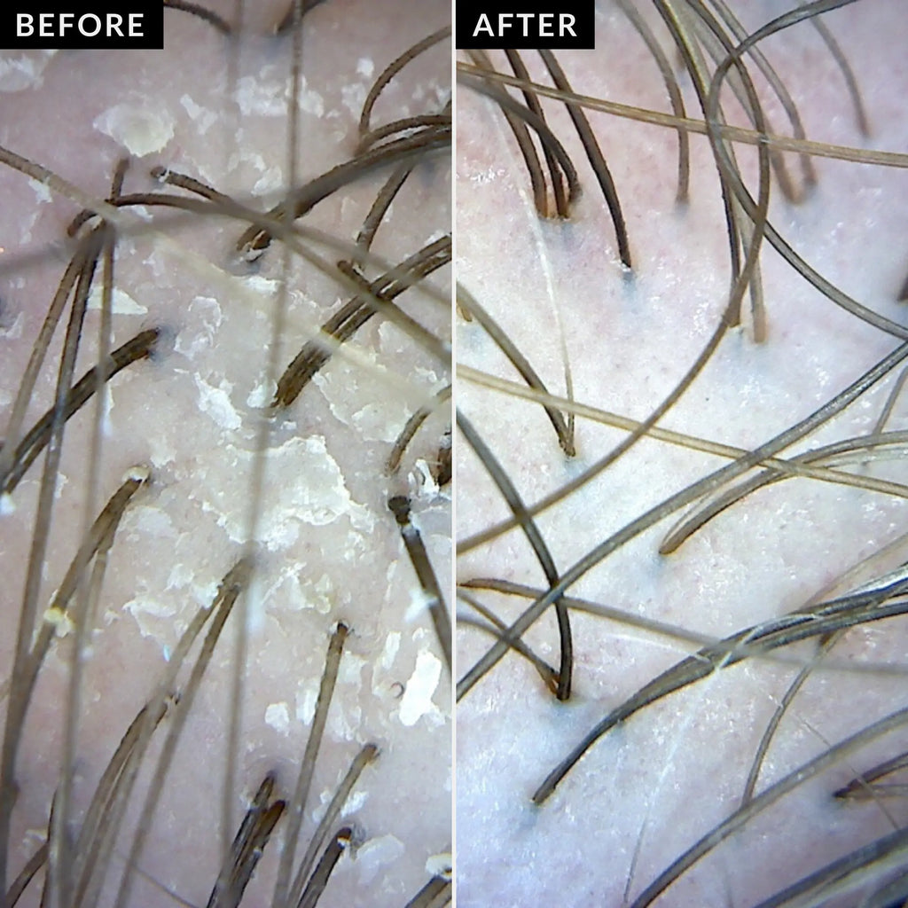 Exfoliating Scalp Scrub (x6)