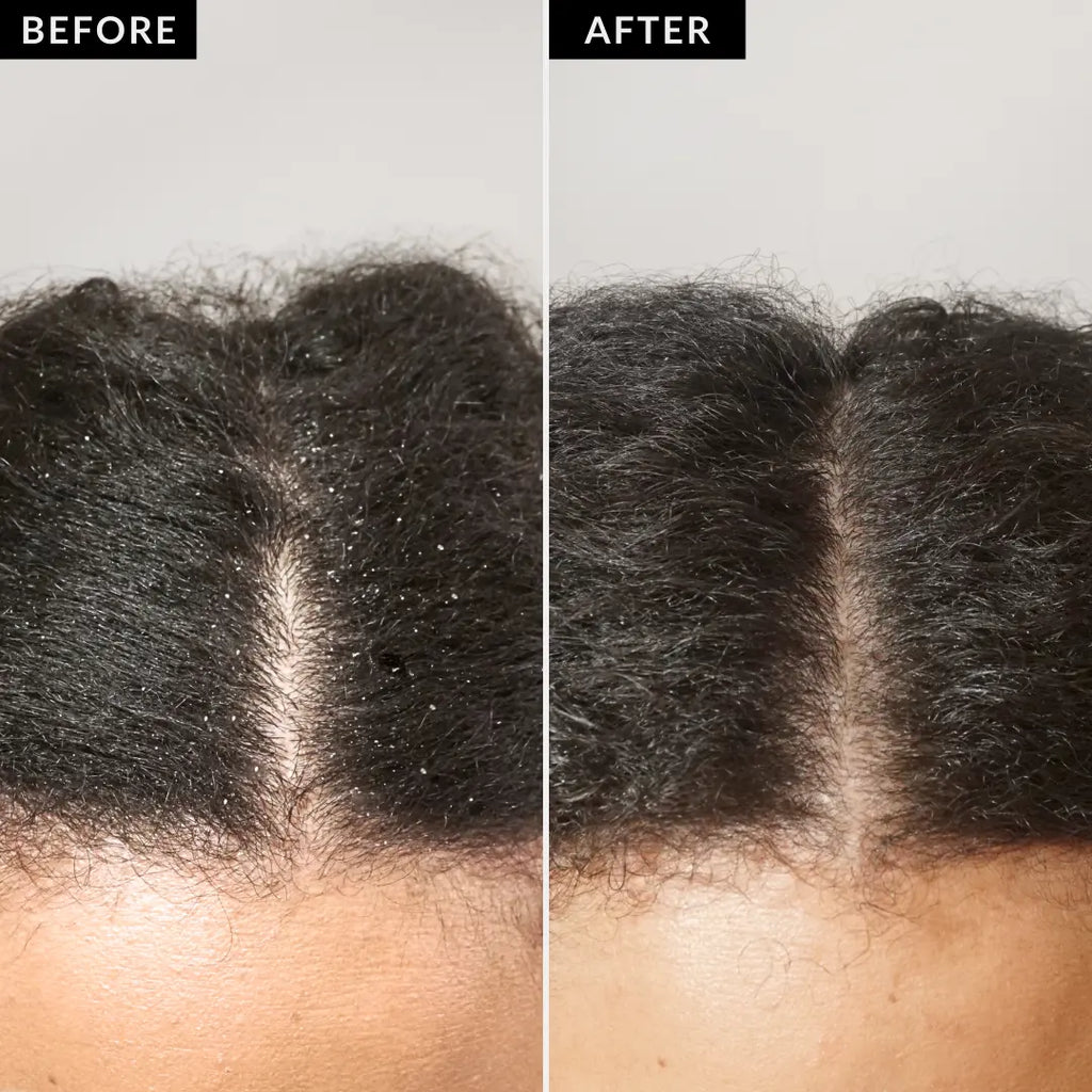 Exfoliating Scalp Scrub (x6)